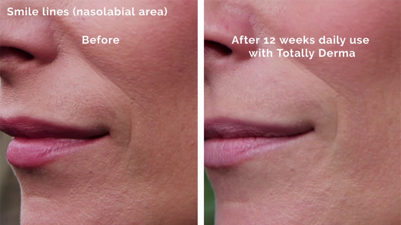 Totally Derma Nutraceutical ital Zsu Atelier
